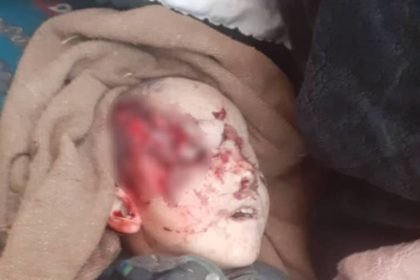 وقوع انفجاری در استان سرپل جان یک کودک را گرفت 