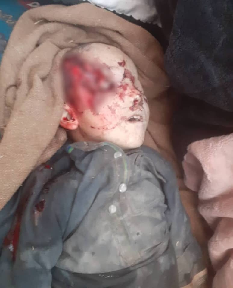 وقوع انفجاری در استان سرپل جان یک کودک را گرفت 