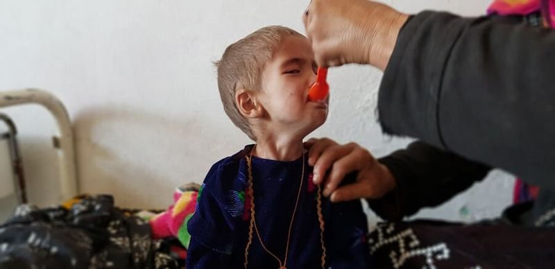 طی نُه ماه پسین ۲۲ کودک در استان غور از اثر بیماری سوءتغذیه جانباختند